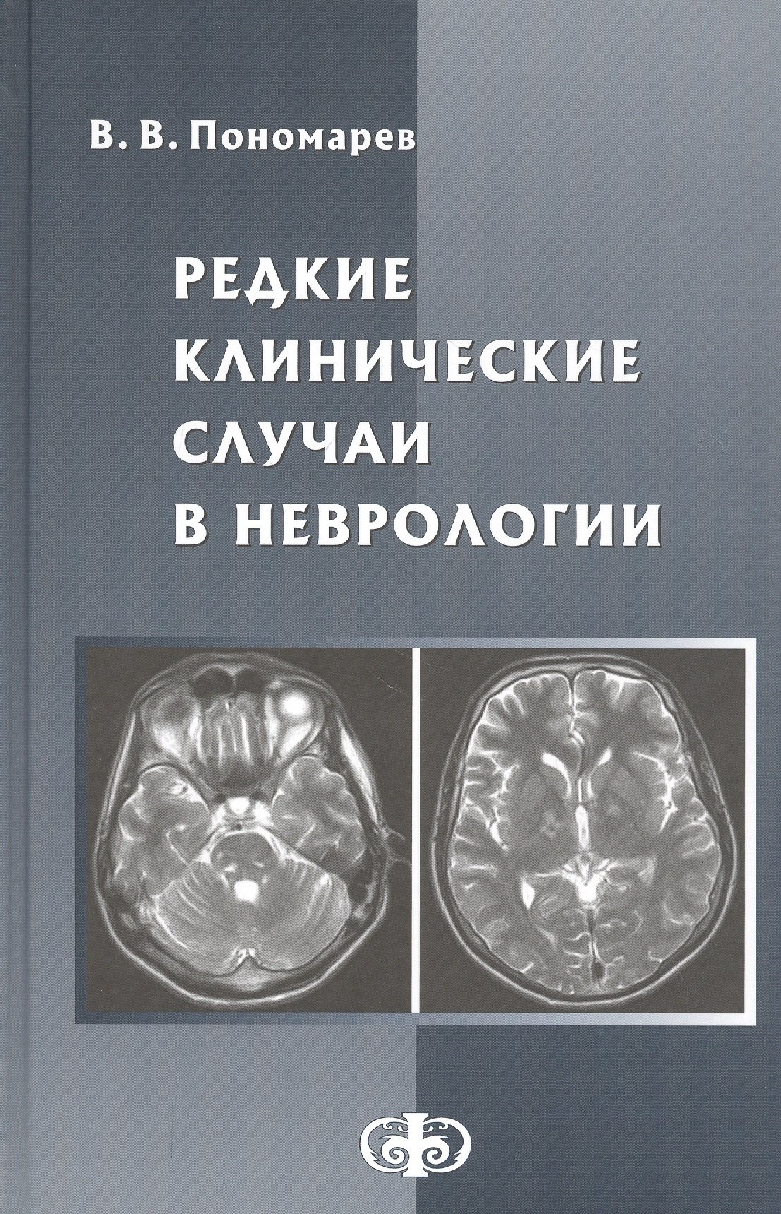 Редкие клинические случаи в неврологии. Руководство для врачей
Редкие клинические случаи в неврологии. Руководство для врачей