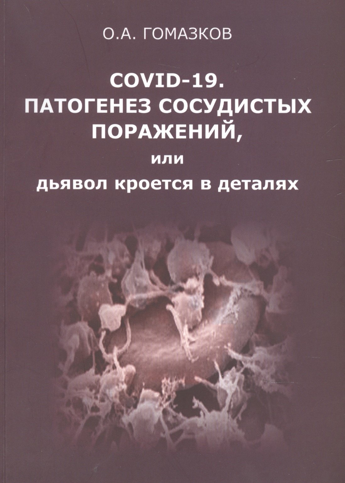 COVID-19. Патогенез сосудистых поражений, или дьявол кроется в деталях. Анализ молекулярных и патофизиологических механизмов COVID-19
COVID-19. Патогенез сосудистых поражений, или дьявол кроется в деталях. Анализ молекулярных и патофизиологических механизмов COVID-19