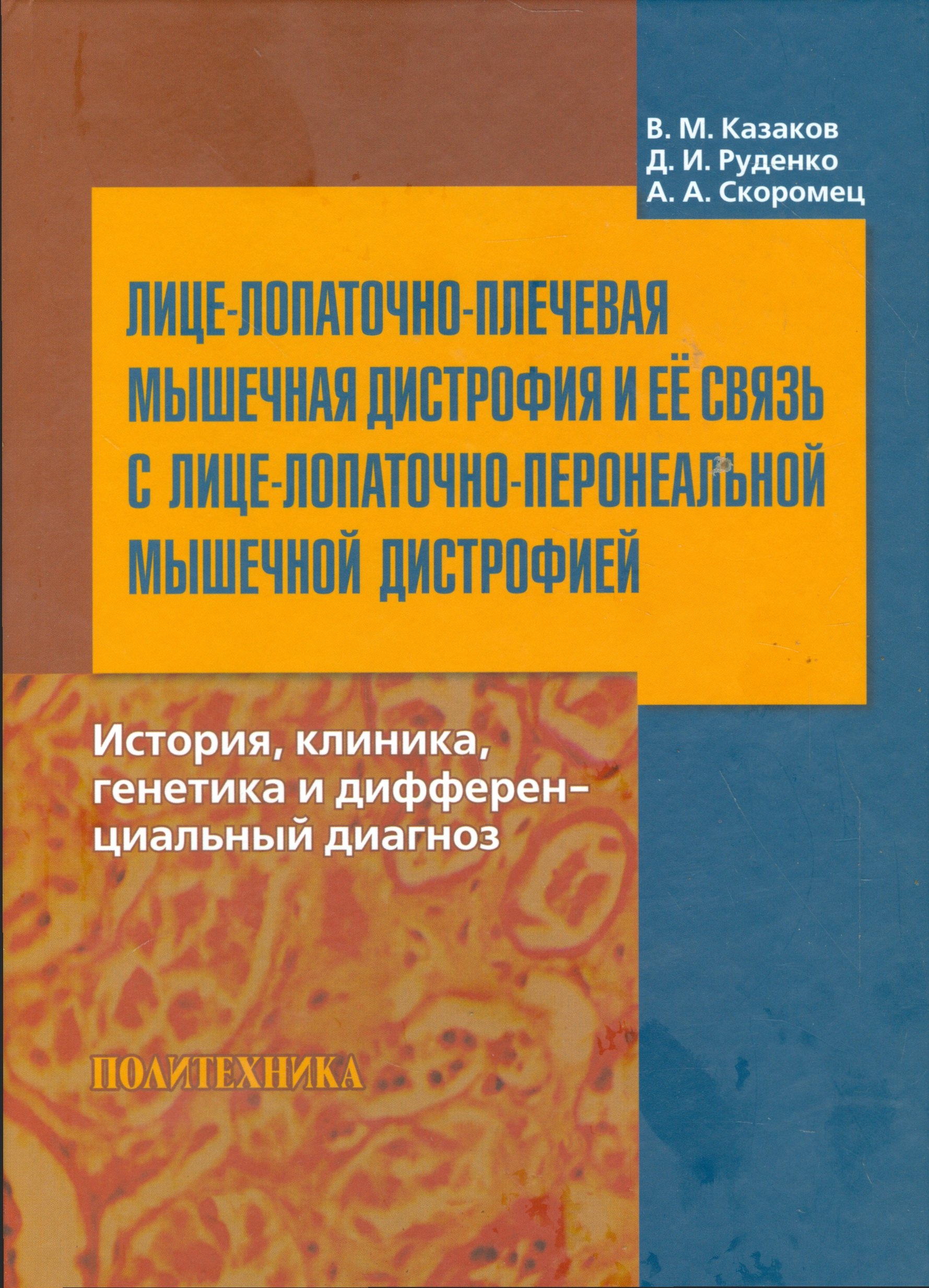 Лице-лопаточно-плечевая мышечная дистрофия и её связь с лице-лопаточно-перонеальной мышечной дистрофией : история, клиника, генетика и дифференциальны
Лице-лопаточно-плечевая мышечная дистрофия и её связь с лице-лопаточно-перонеальной мышечной дистрофией : история, клиника, генетика и дифференциальны