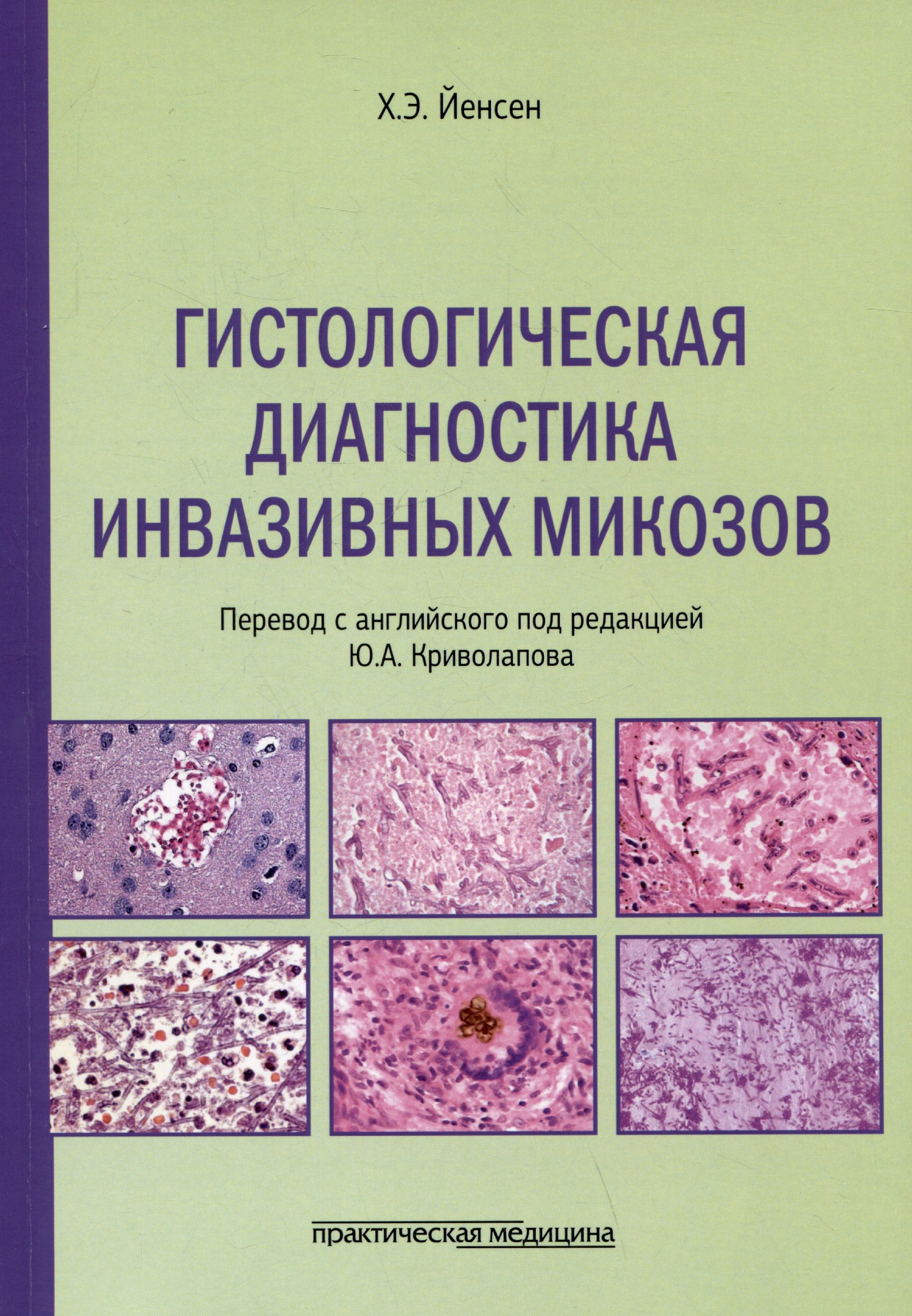 Гистологическая диагностика инвазивных микозов