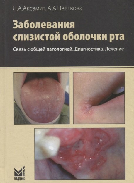 Заболевания слизистой оболочки рта. Связь с общей патологией. Диагностика. Лечение. 2-е изд.
Заболевания слизистой оболочки рта. Связь с общей патологией. Диагностика. Лечение. 2-е изд.