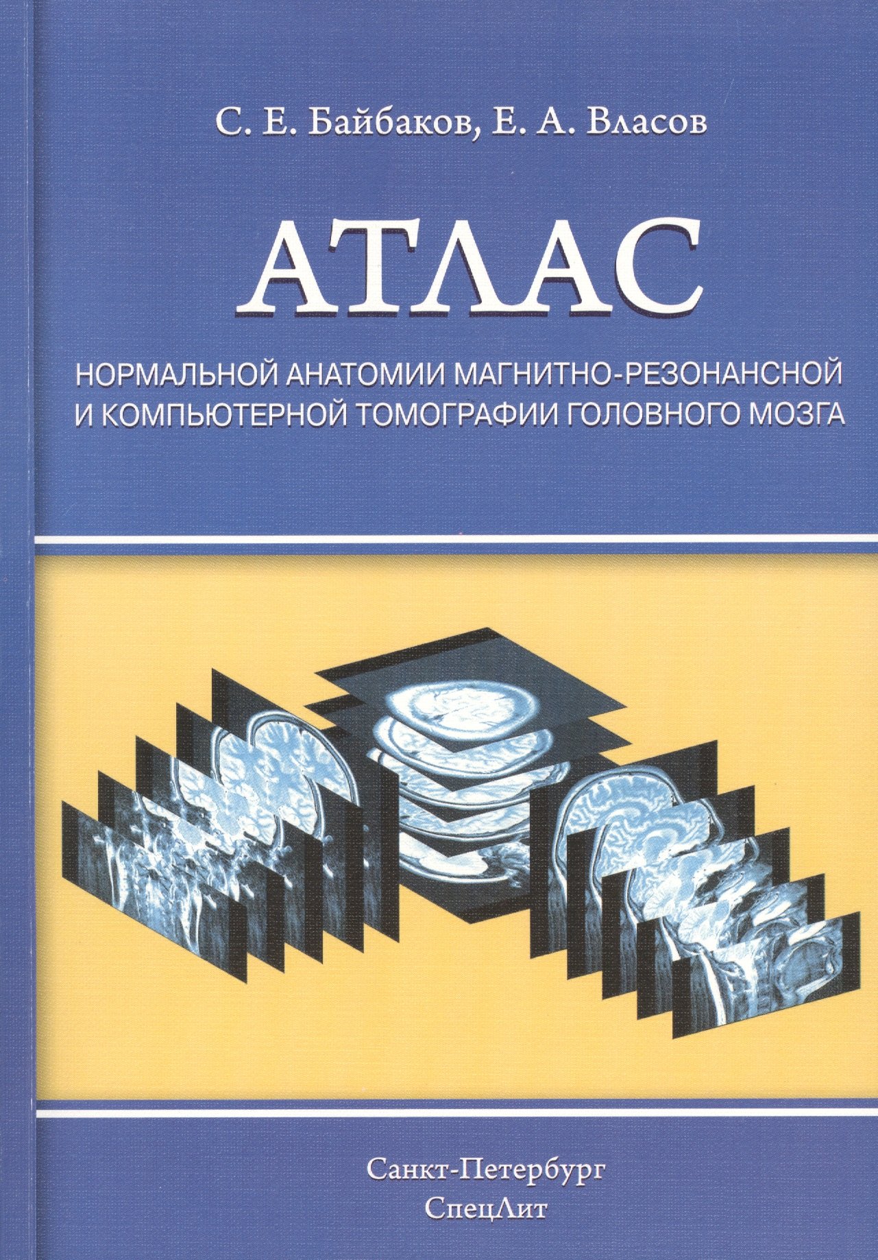 Атлас нормальной анатомии магнитно-резонансной и компьютерной томографии головного мозга : уебное пособие
Атлас нормальной анатомии магнитно-резонансной и компьютерной томографии головного мозга : уебное пособие