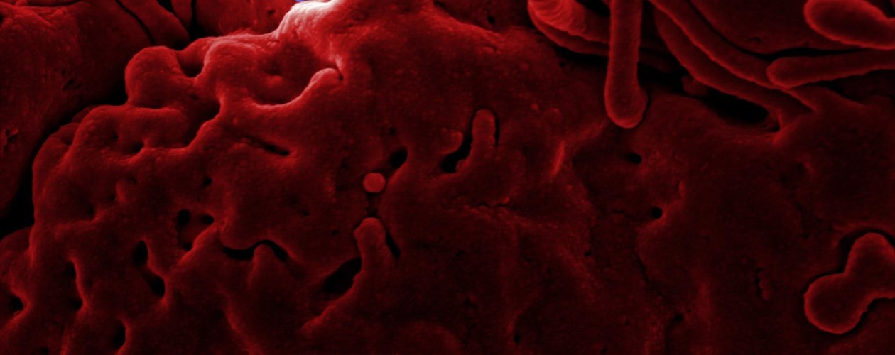 Как появилась книга, по которой сняли сериал «Эпидемия»