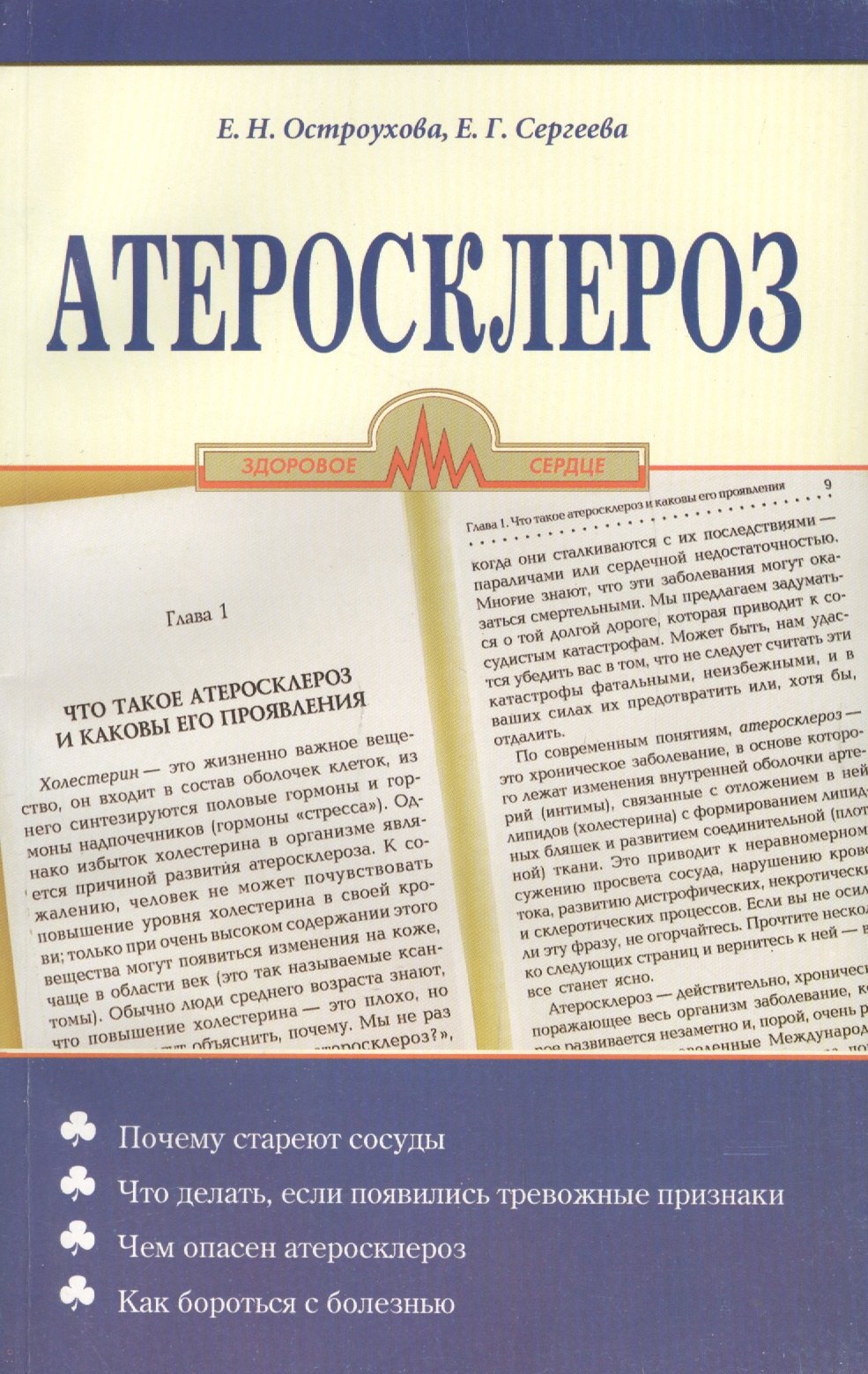 

Атеросклероз (мягк). Остроухова Е. (Диля)