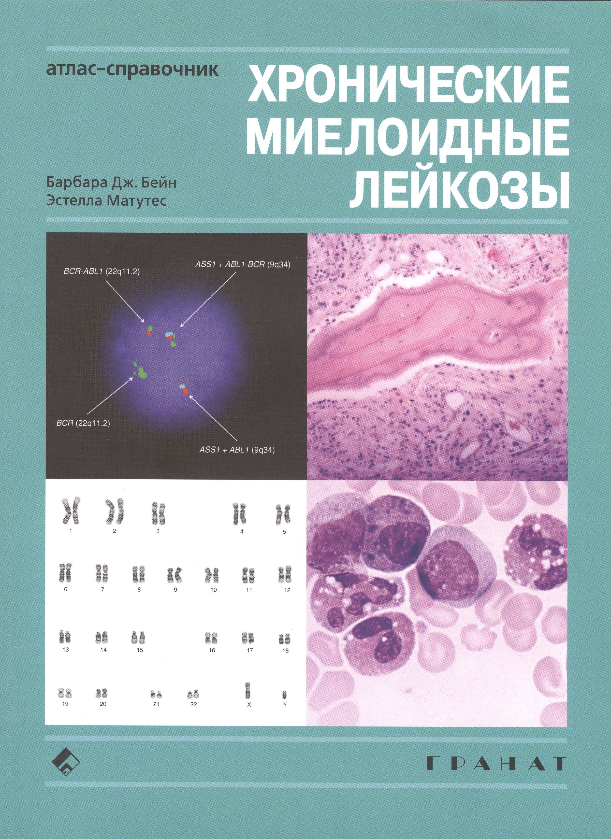 

Хронические миелоидные лейкозы. Атлас-справочник. М: ГРАНАТ