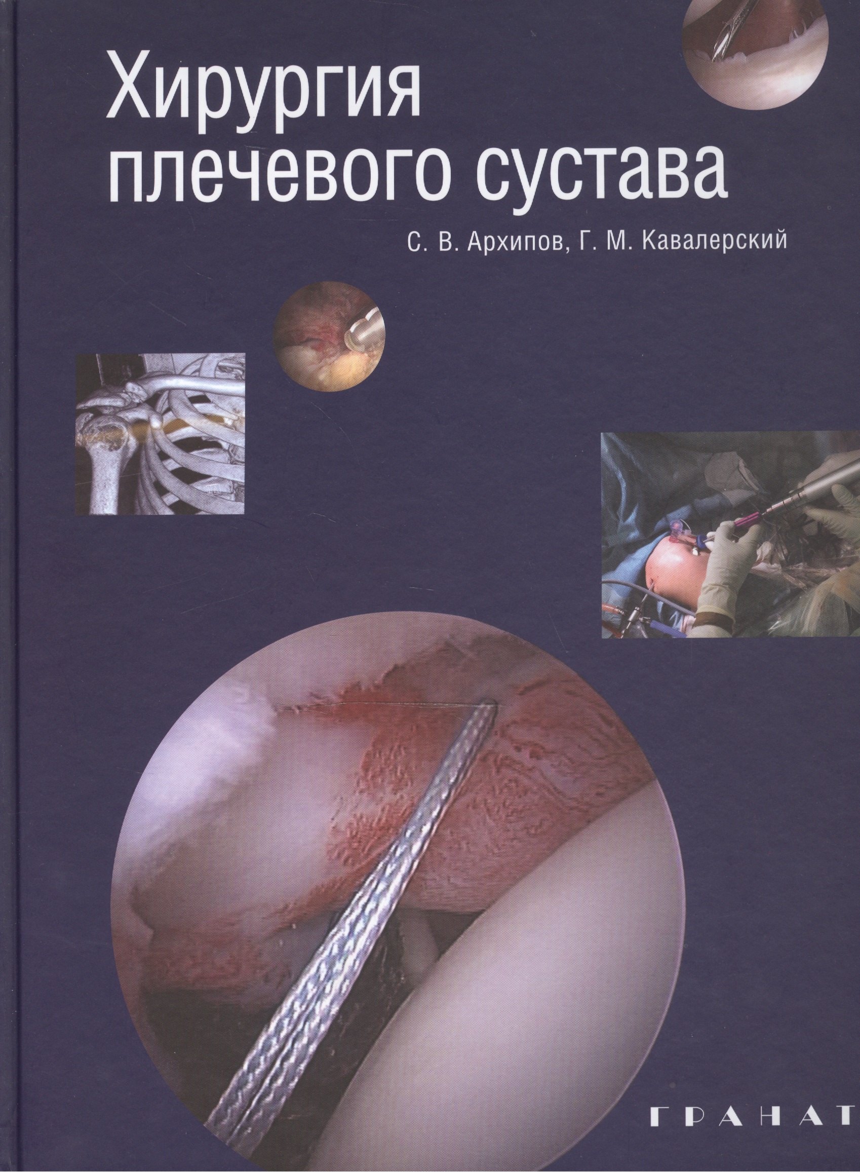 

Хирургия плечевого сустава