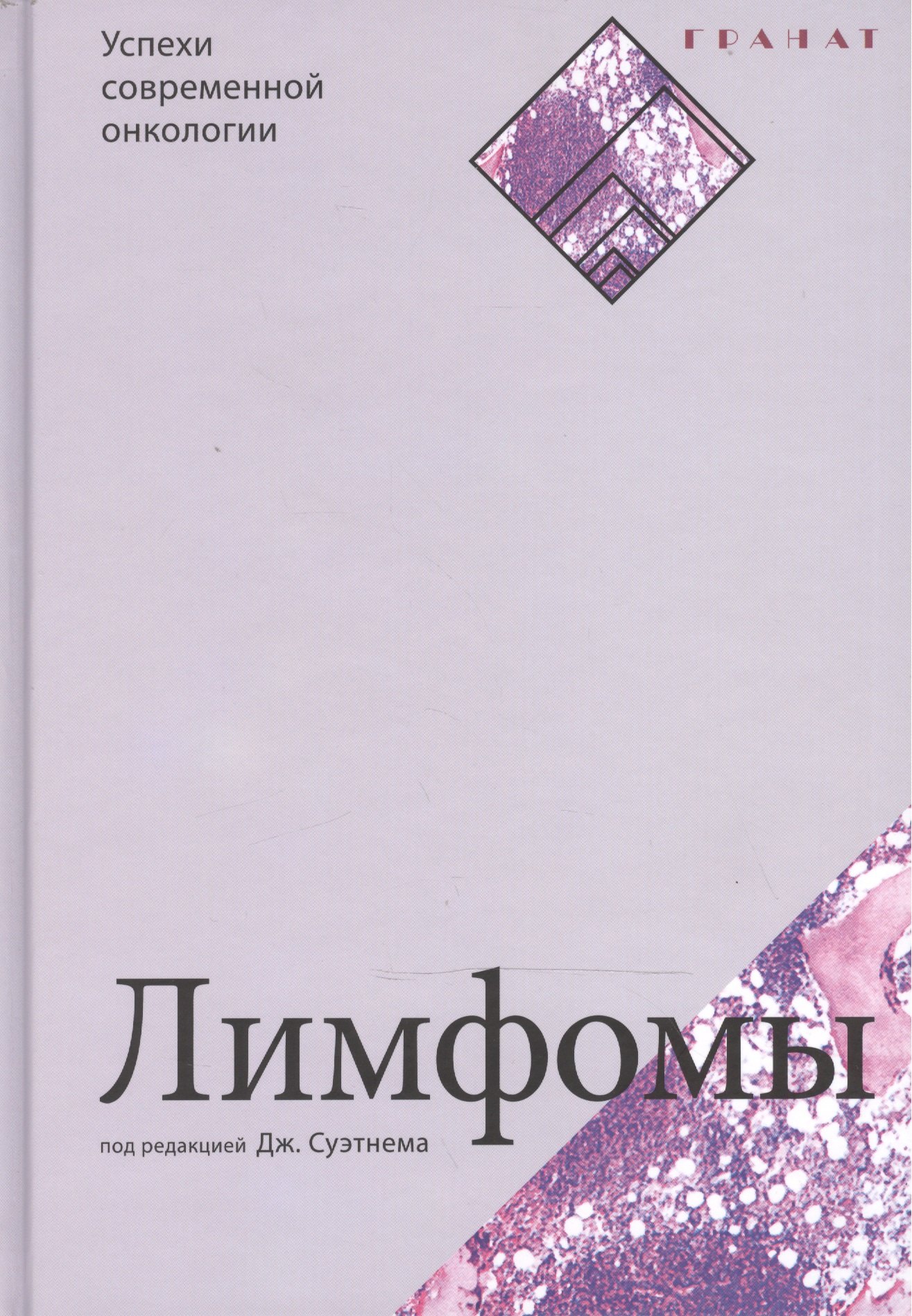 

Лимфомы. Серия «Успехи современной онкологии» № 2.