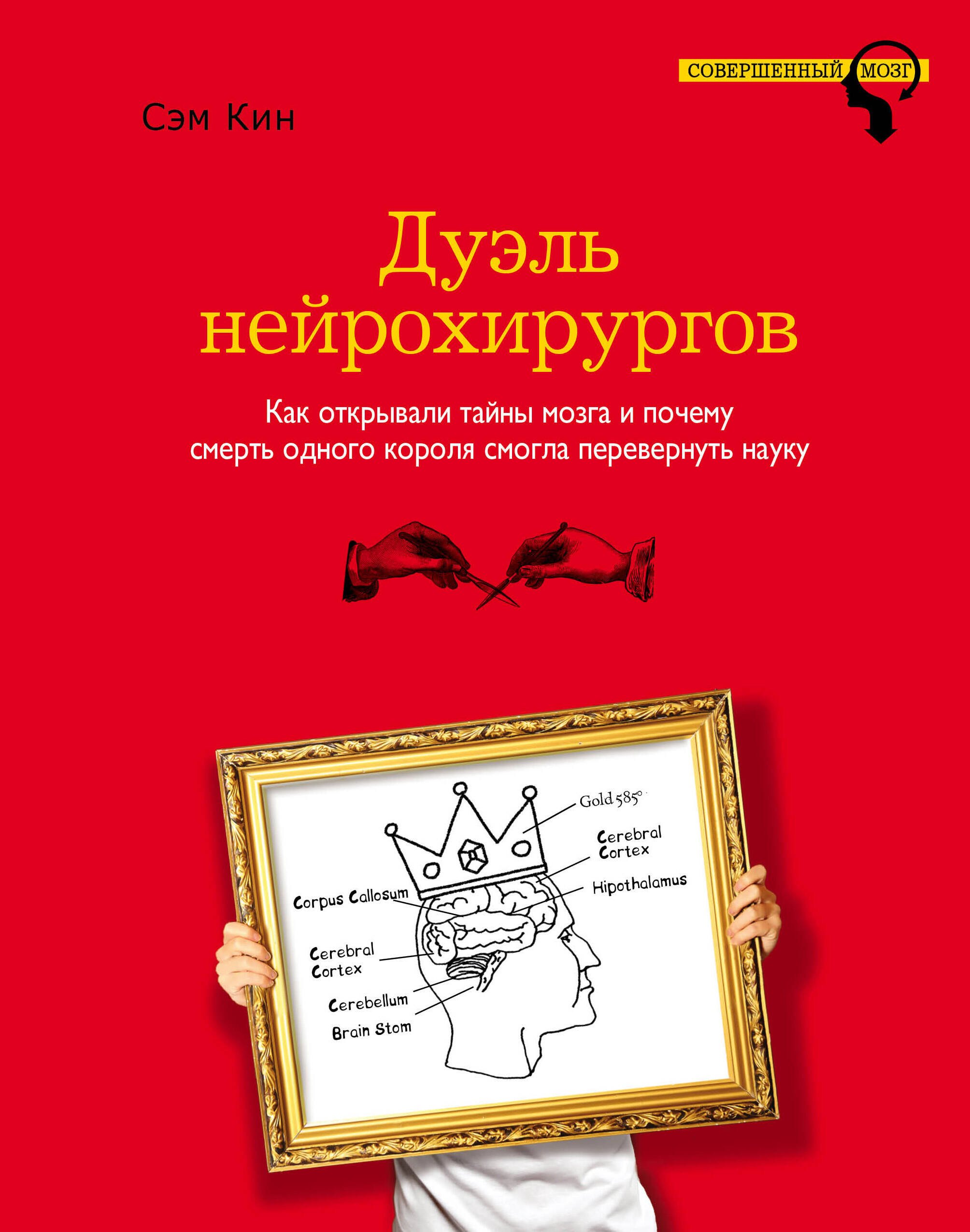 

Дуэль нейрохирургов. Как открывали тайны мозга и почему смерть одного короля смогла перевернуть науку