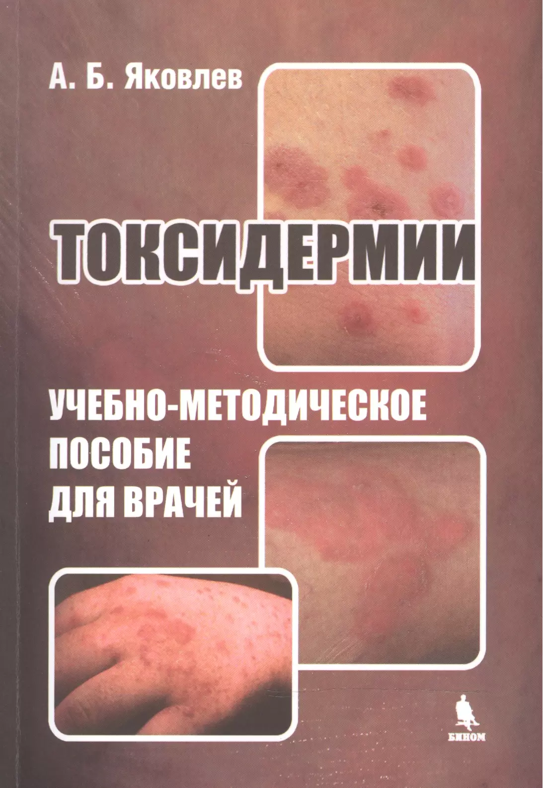 Яковлев Алексей Борисович Токсидермии. Учебно-методическое пособие для врачей