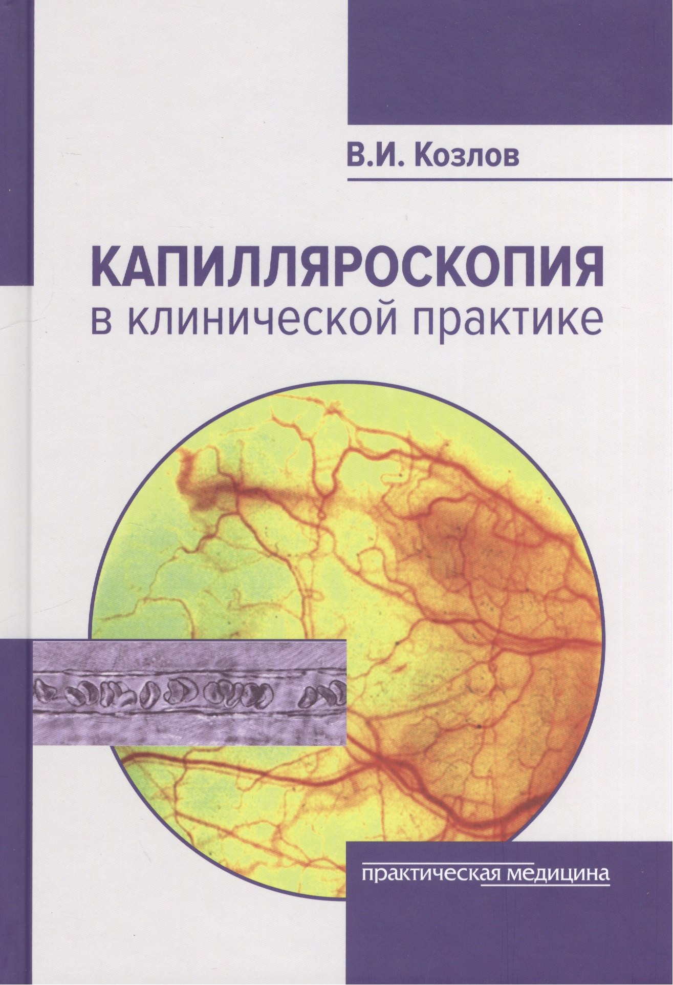 

Капилляроскопия в клинической практике (Козлов)