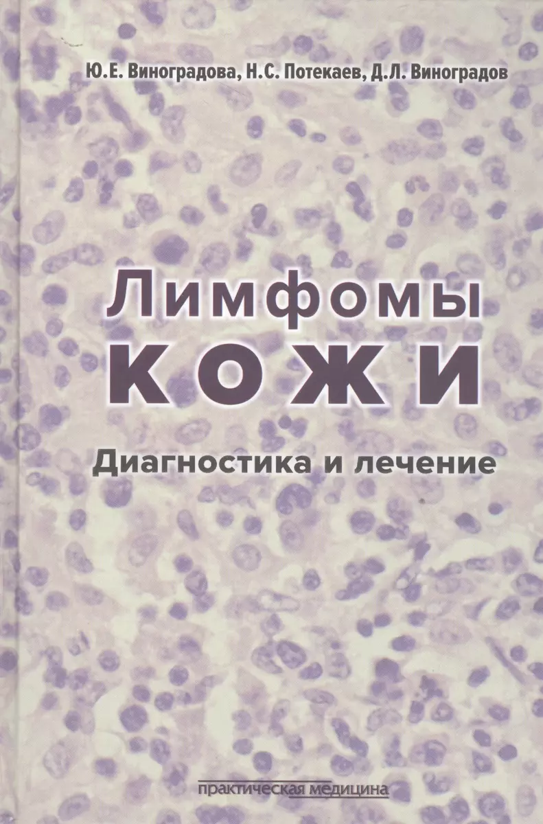 Лимфомы кожи. Диагностика и лечение - купить книгу с доставкой в  интернет-магазине «Читай-город». ISBN: 978-5-98-811256-3