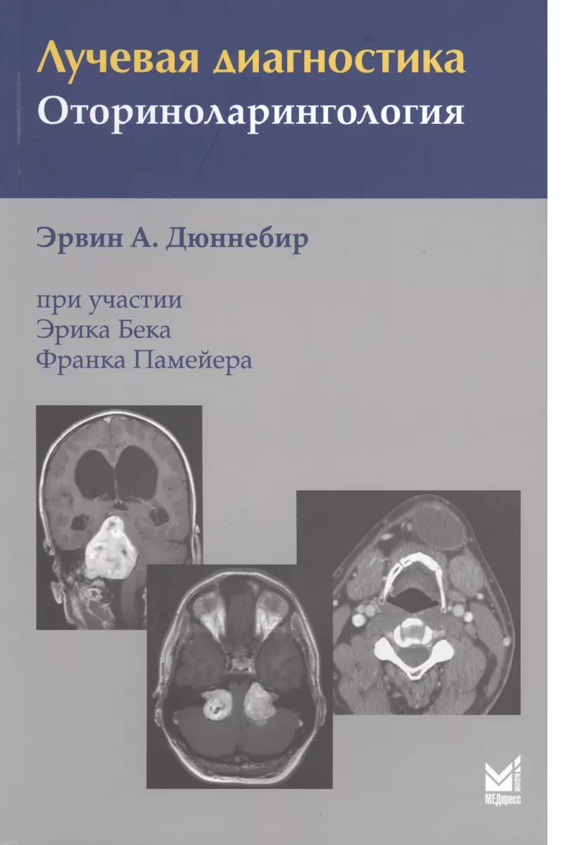 Лучевая Диагностика. Оториноларингология (Эрвин Дюннебир) - Купить.