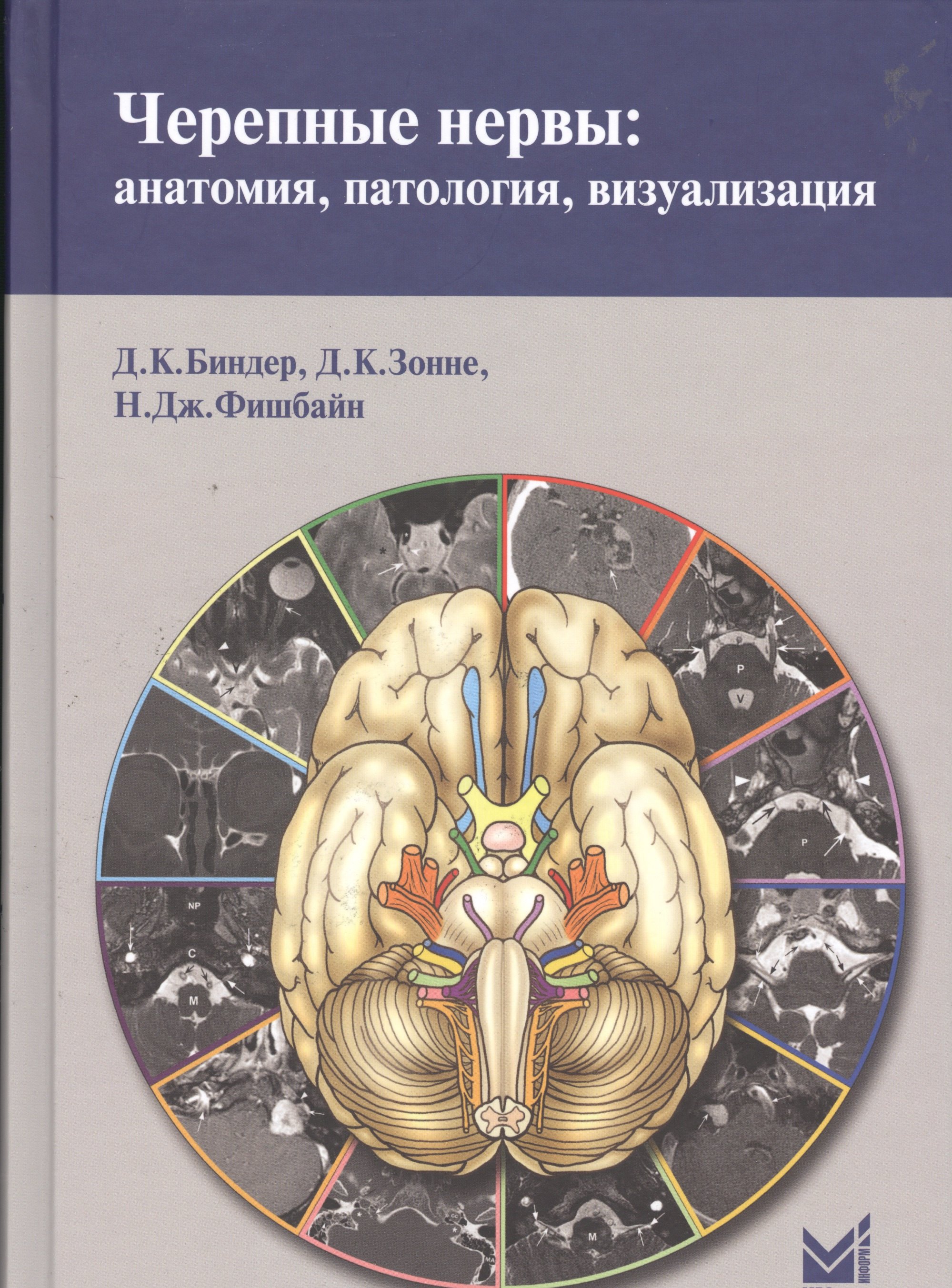 

Черепные нервы: анатомия, патология, визуализация.