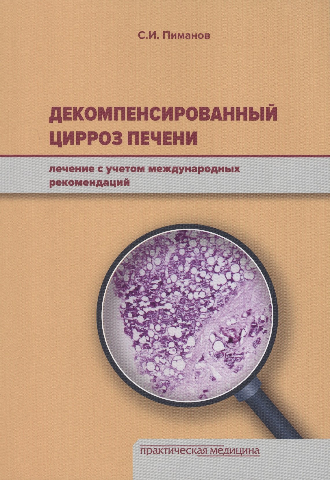 

Декомпенсированный цирроз печени: лечение с учетом международных рекомендаций.