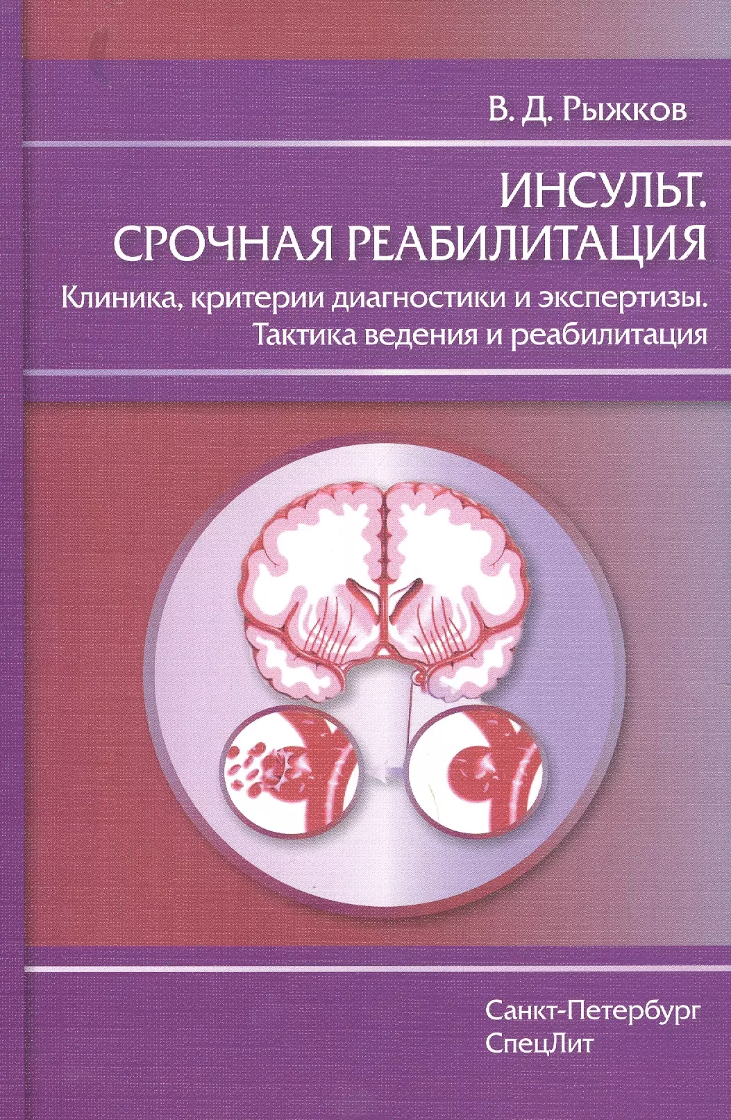 

Инсульт.Срочная реабилитация