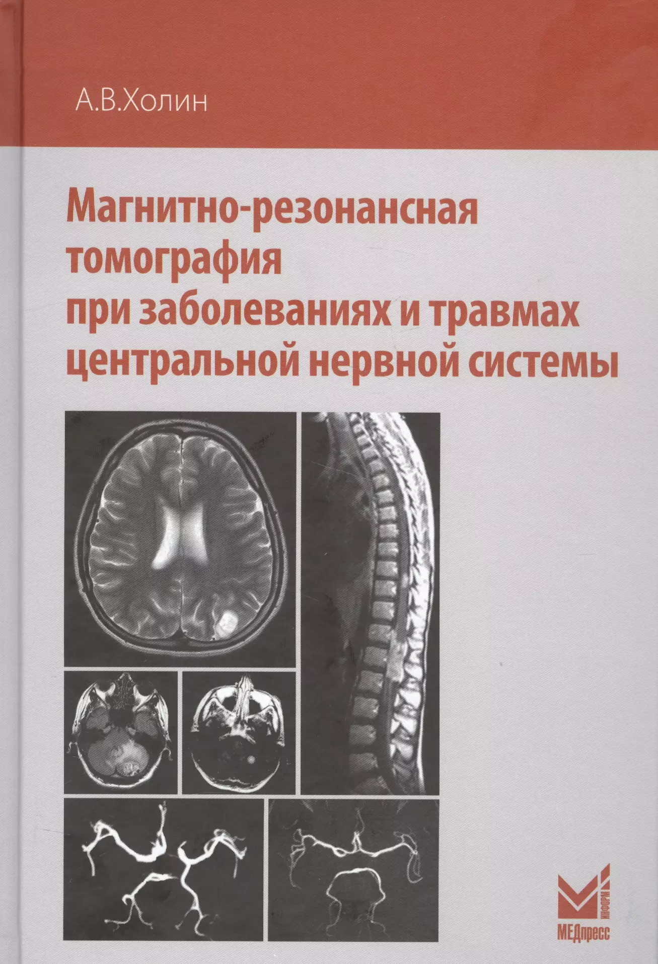 Холин Александр Васильевич - Магнитно-резонансная томография при заболеваниях и травмах центральной нервной системы