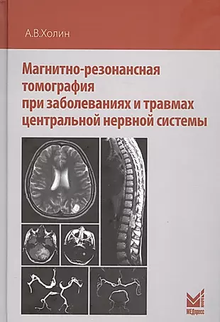 Магнитно-резонансная томография при заболеваниях и травмах центральной нервной системы — 2582426 — 1
