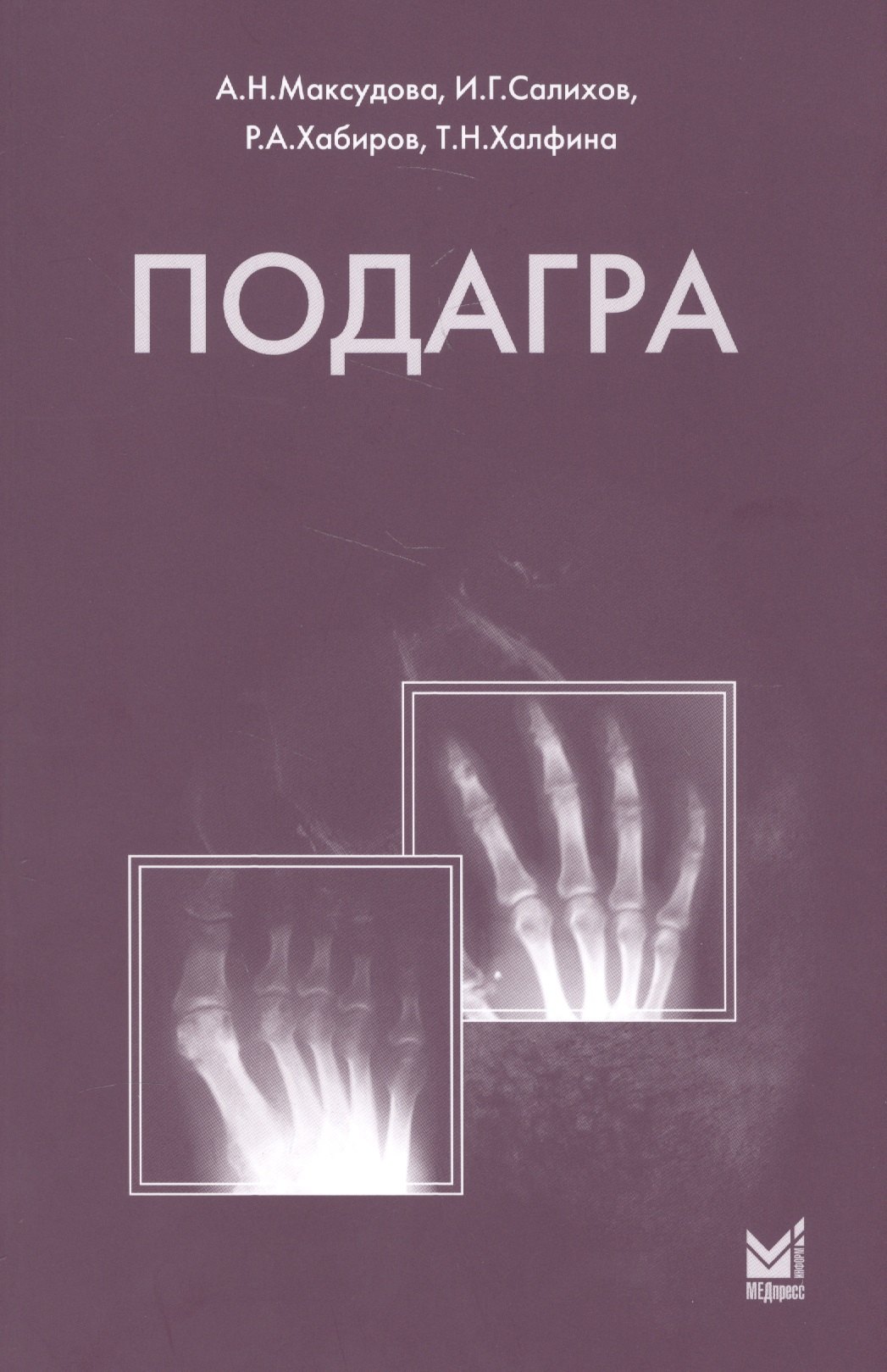 

Подагра
