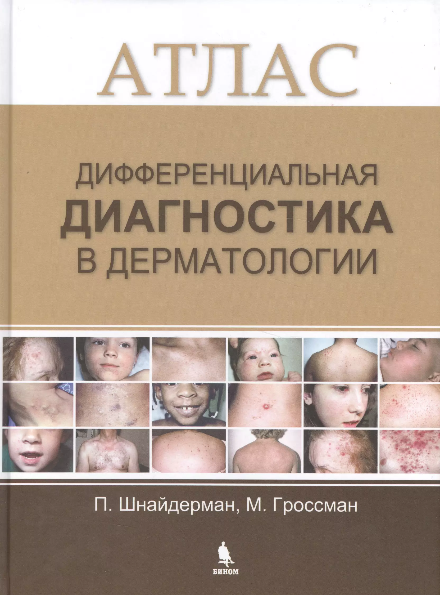 Анализ дерматологии. Дифференциальная дерматология атлас. Дифференциальная диагностика. Атлас по кожным заболеваниям.