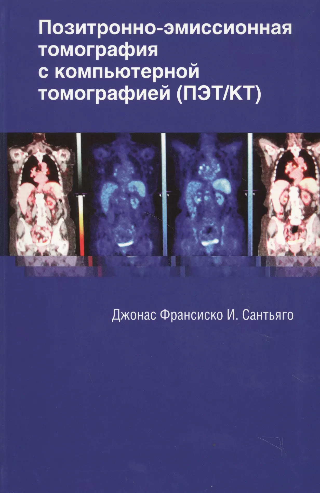 Сантьяго Джонас Франсиско И. - Позитронно-эмиссионная томография с компьютерной томографией (ПЭТ/КТ)