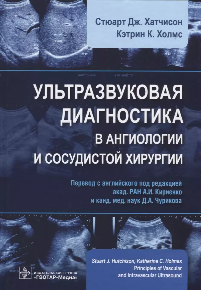 Хатчисон Стюарт Дж. - Ультразвуковая диагностика в ангиологии и сосудистой хирургии (Хатчисон)