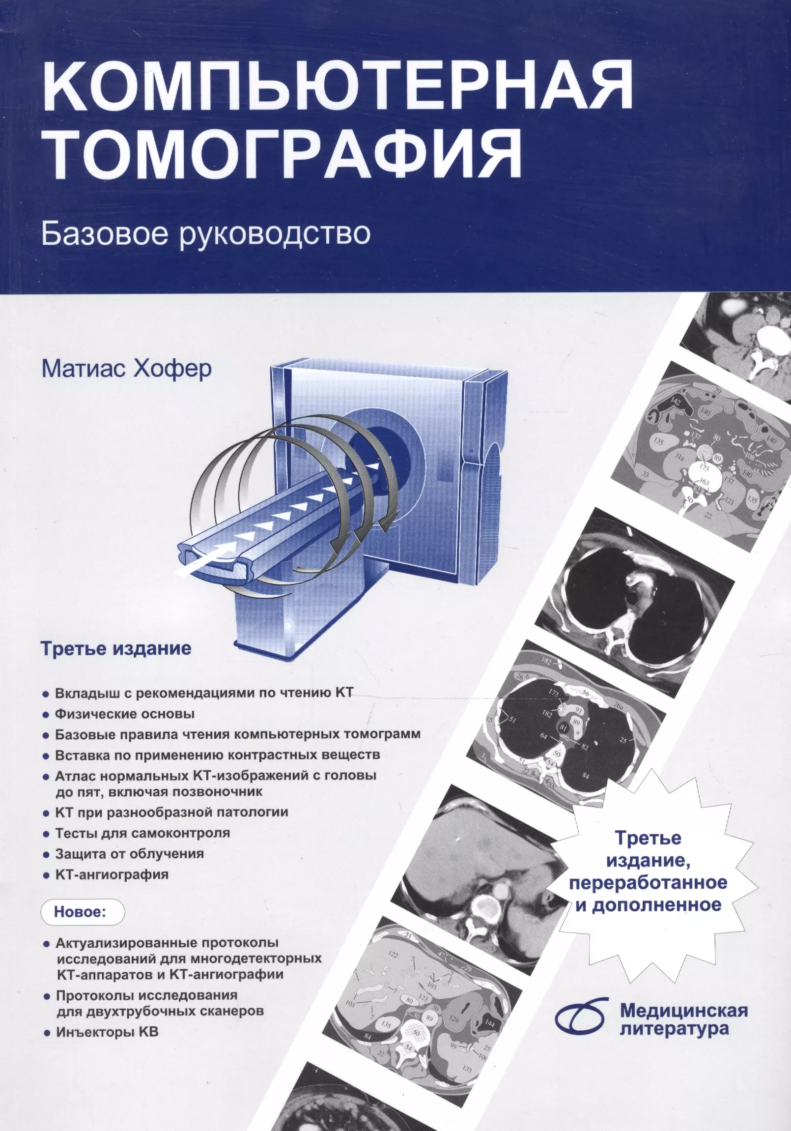 Хофер Матиас - Компьютерная томография Базовое руководство