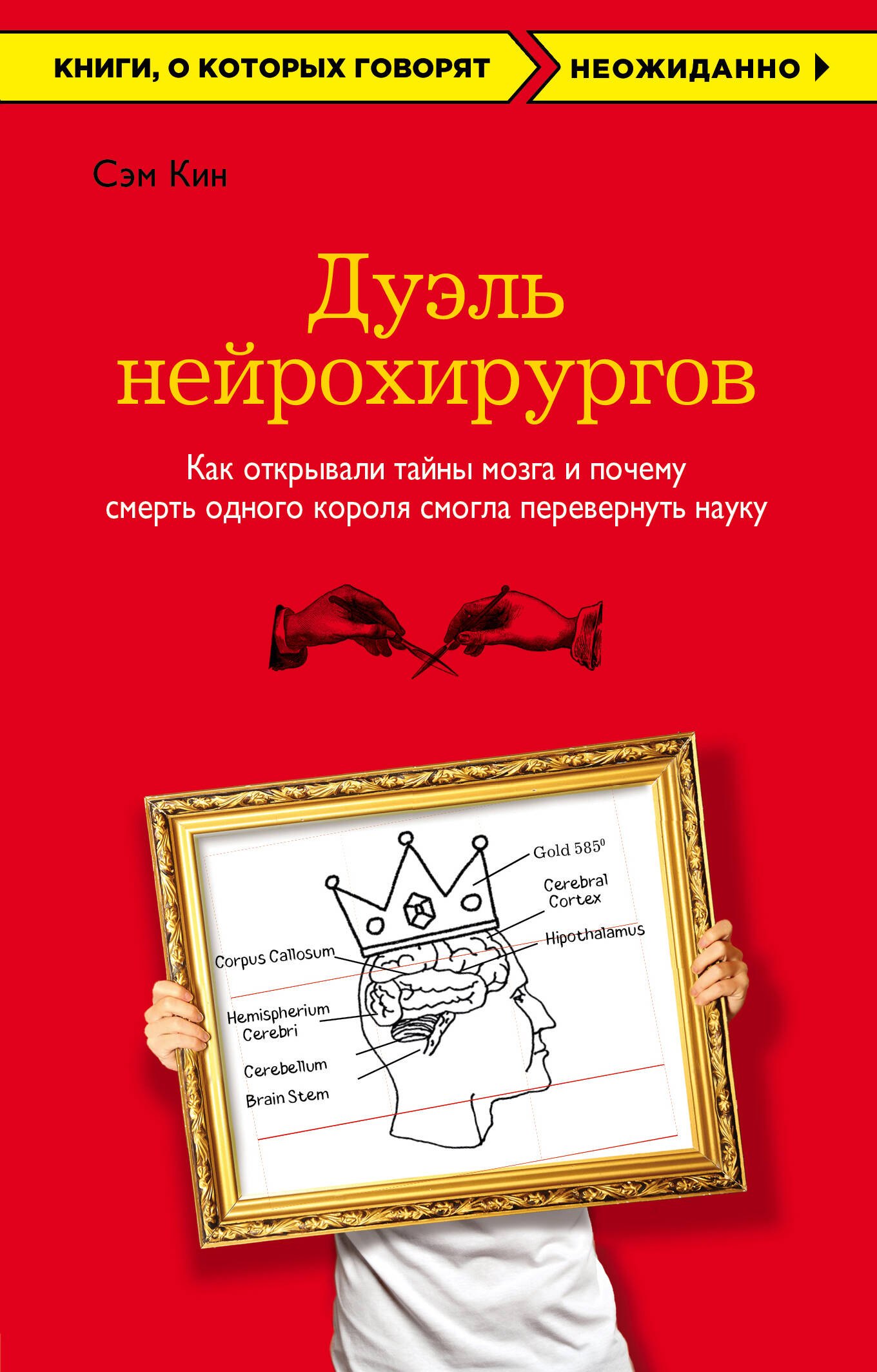 

Дуэль нейрохирургов. Как открывали тайны мозга, и почему смерть одного короля смогла перевернуть науку