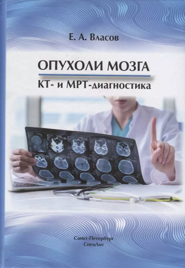 Власов Евгений Александрович - Опухоли мозга КТ- и МРТ- диагностика