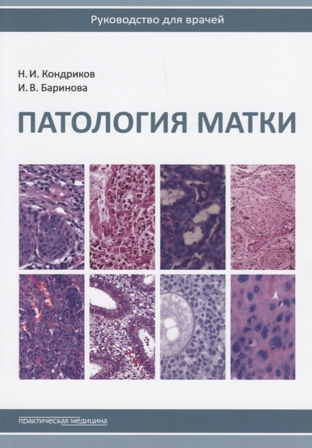 

Патология матки Руководство для врачей (2 изд.) (м) Кондриков