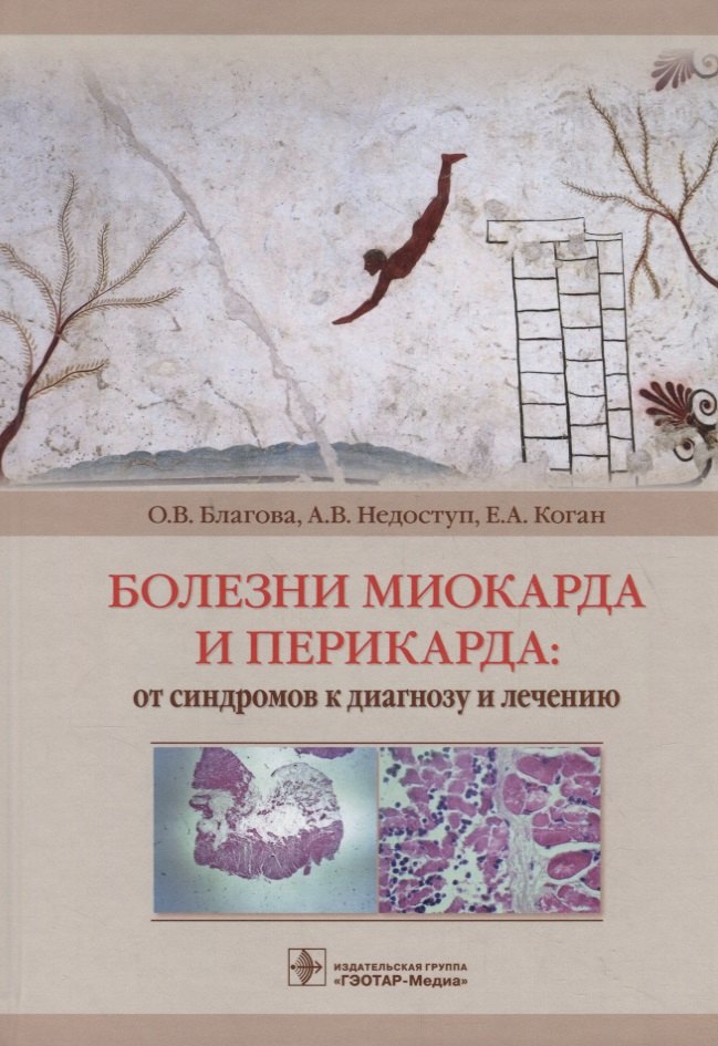 

Болезни миокарда и перикарда: от синдромов к диагнозу и лечению