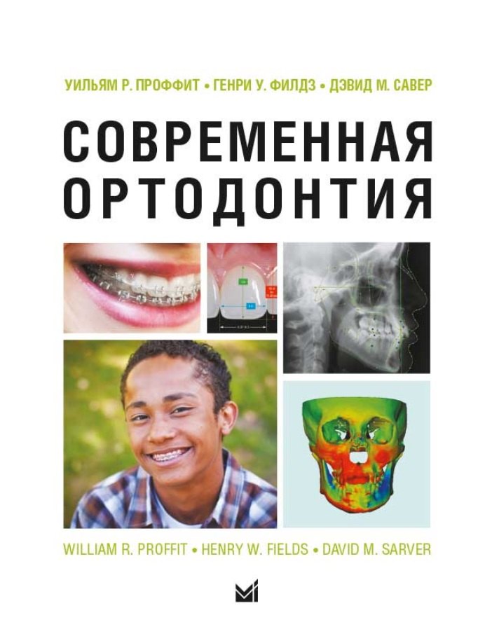 

Современная ортодонтия