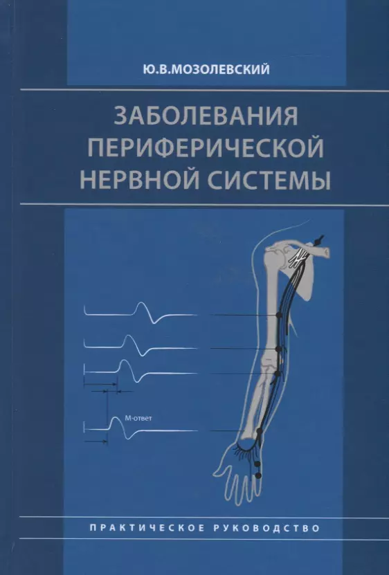 

Заболевания периферической нервной системы. Практическое руководство