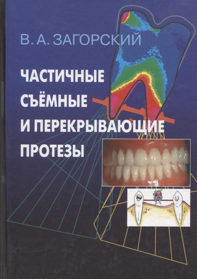 

Частичные съемные и перекрывающие протезы. Морфология и ультраструктура