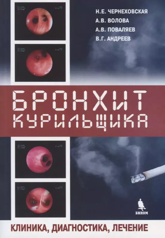 Чернеховская Наталья Евгеньевна Бронхит курильщика. Клиника, диагностика, лечение