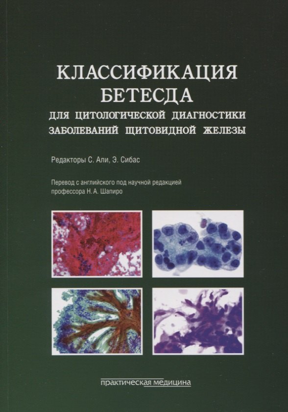 

Классификация Бетесда для цитологической диагностики заболеваний щитовидной железы. Терминология, критерии и пояснения