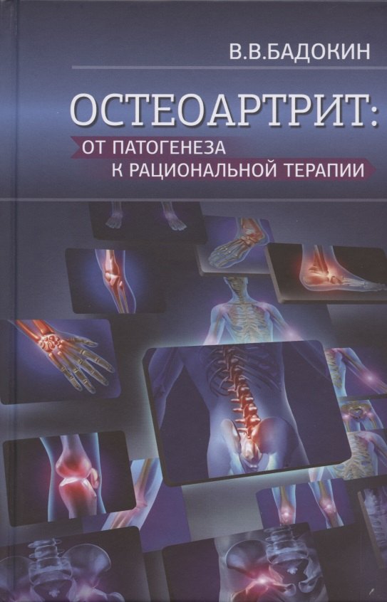 

Остеоартрит: от патогенеза к рациональной терапии