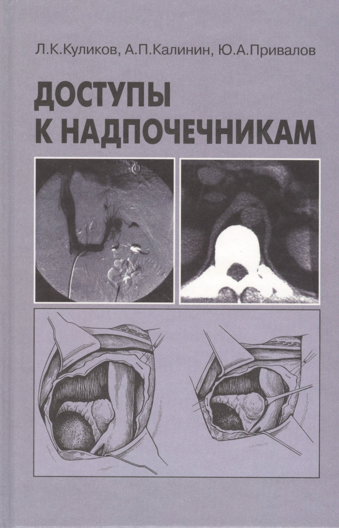 Доступы к надпочечникам. Руководство для врачей новикова в п бехтерова м к лямблиоз руководство для врачей