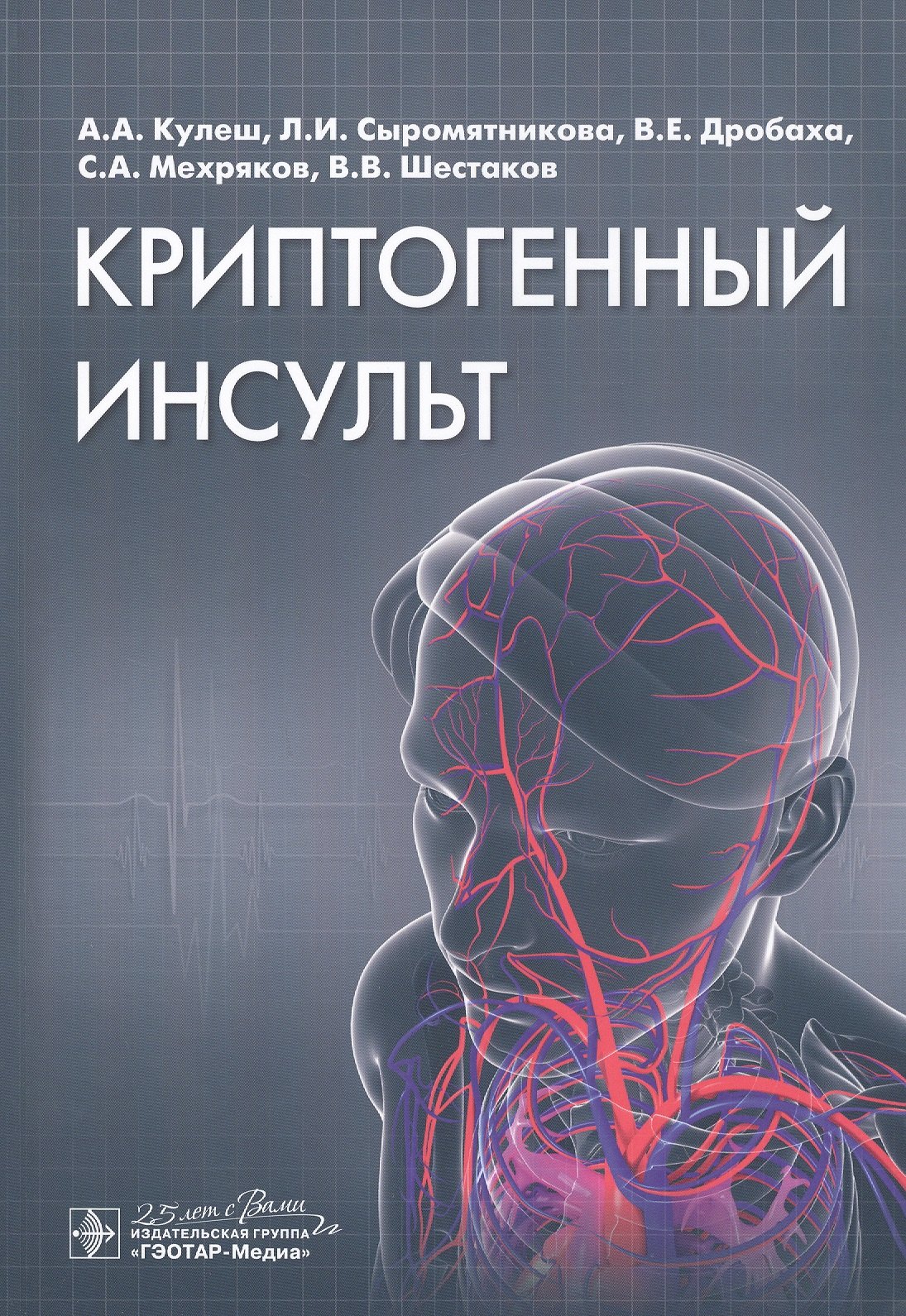 

Криптогенный инсульт. Руководство
