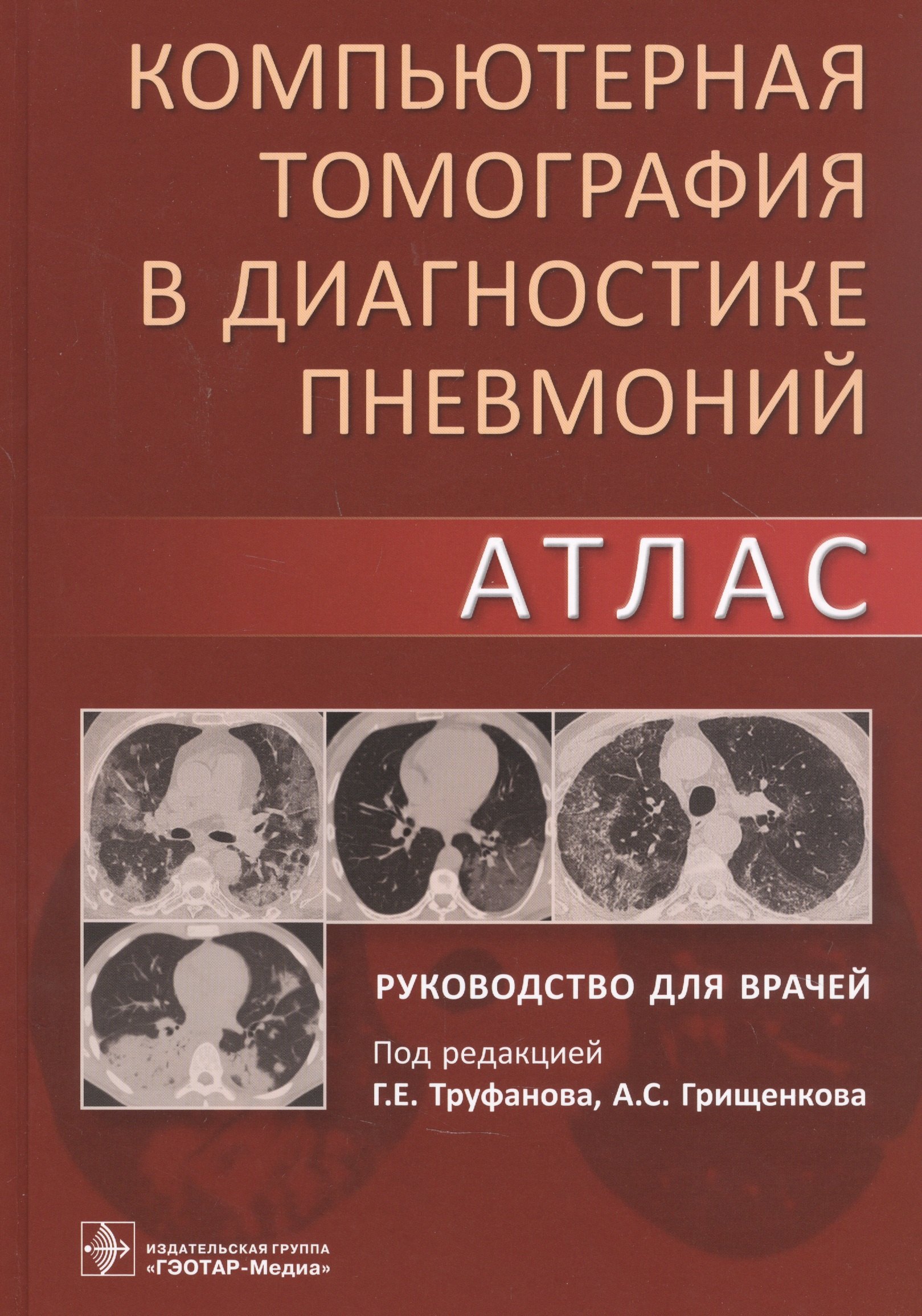 

Компьютерная томография в диагностике пневмоний. Атлас. Руководство для врачей