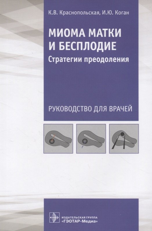 

Миома матки и бесплодие. Стратегии преодоления. Руководство для врачей