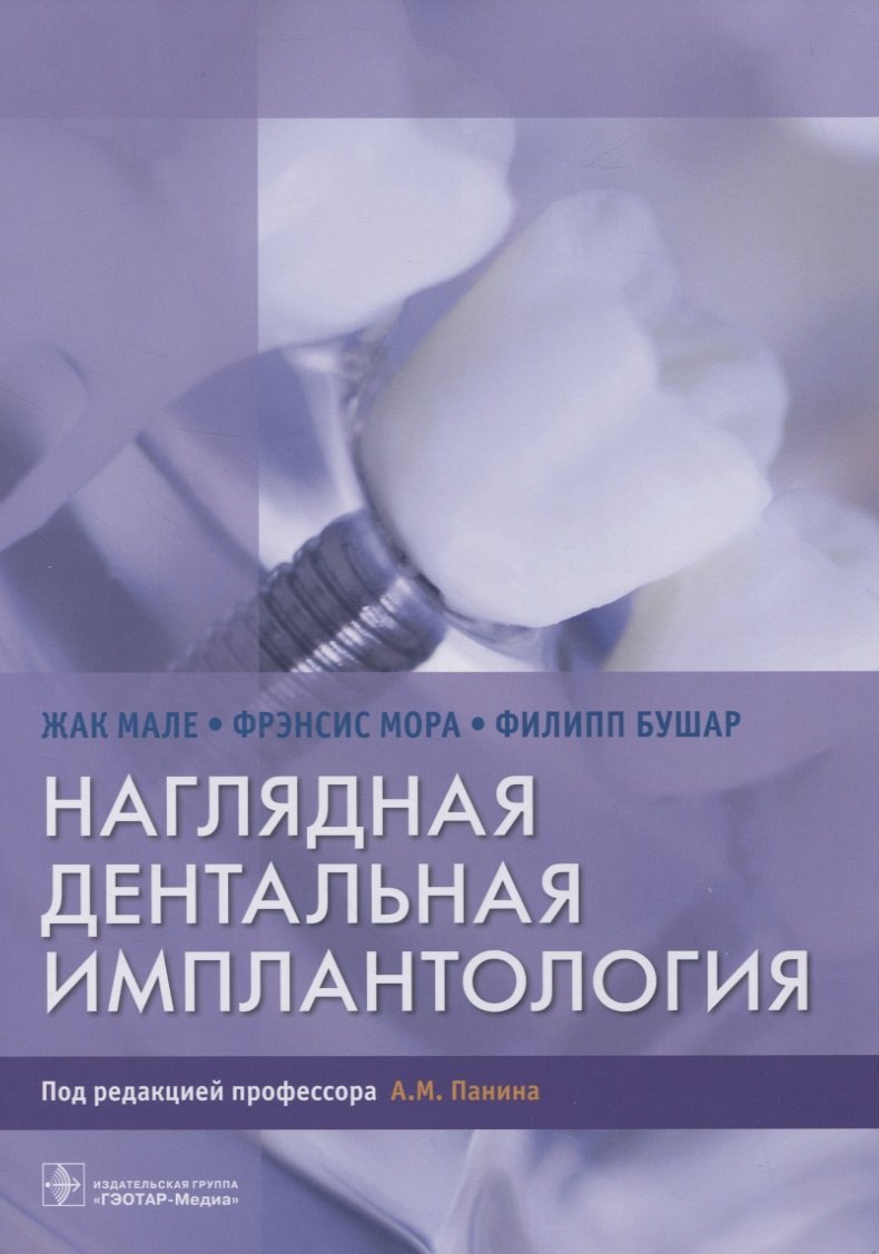 

Наглядная дентальная имплантология