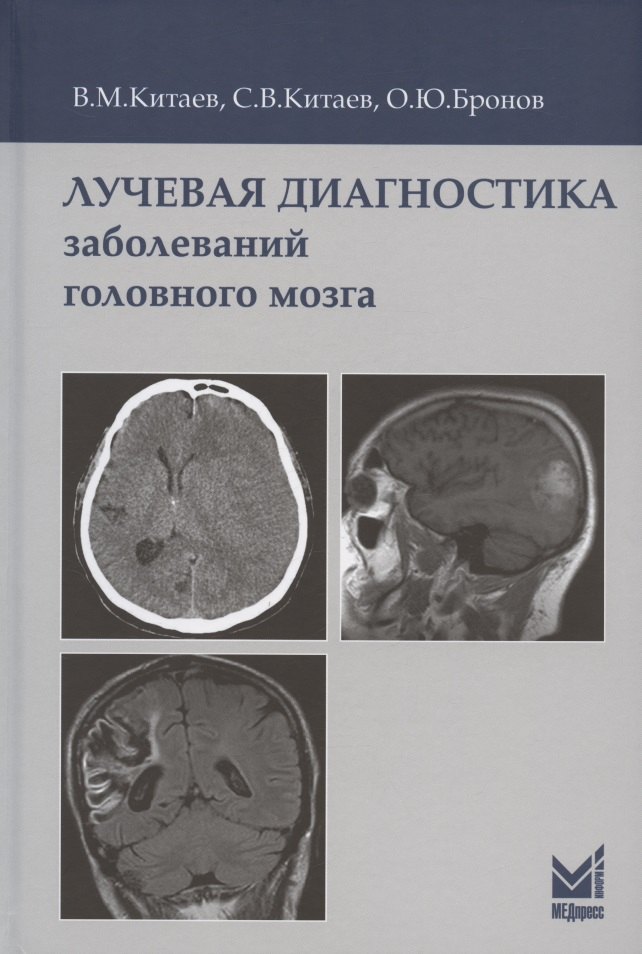 

Лучевая диагностика заболеваний головного мозга. 3-е издание