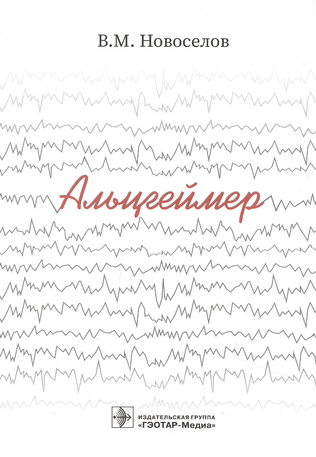 

Альцгеймер