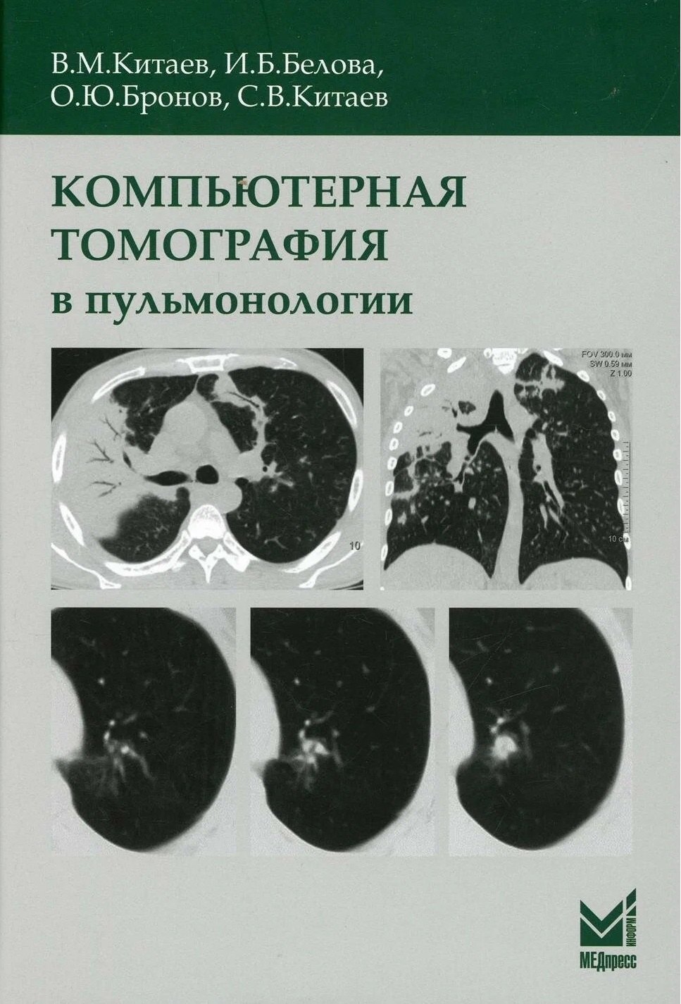 

Компьютерная томография в пульмонологии
