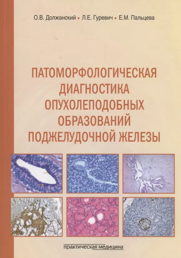 Пальцева Екатерина Михайловна, Должанский Олег Владимирович, Гуревич Лариса Евсеевна - Патоморфологическая диагностика опухолеподобных образований поджелудочной железы. Руководство для врачей