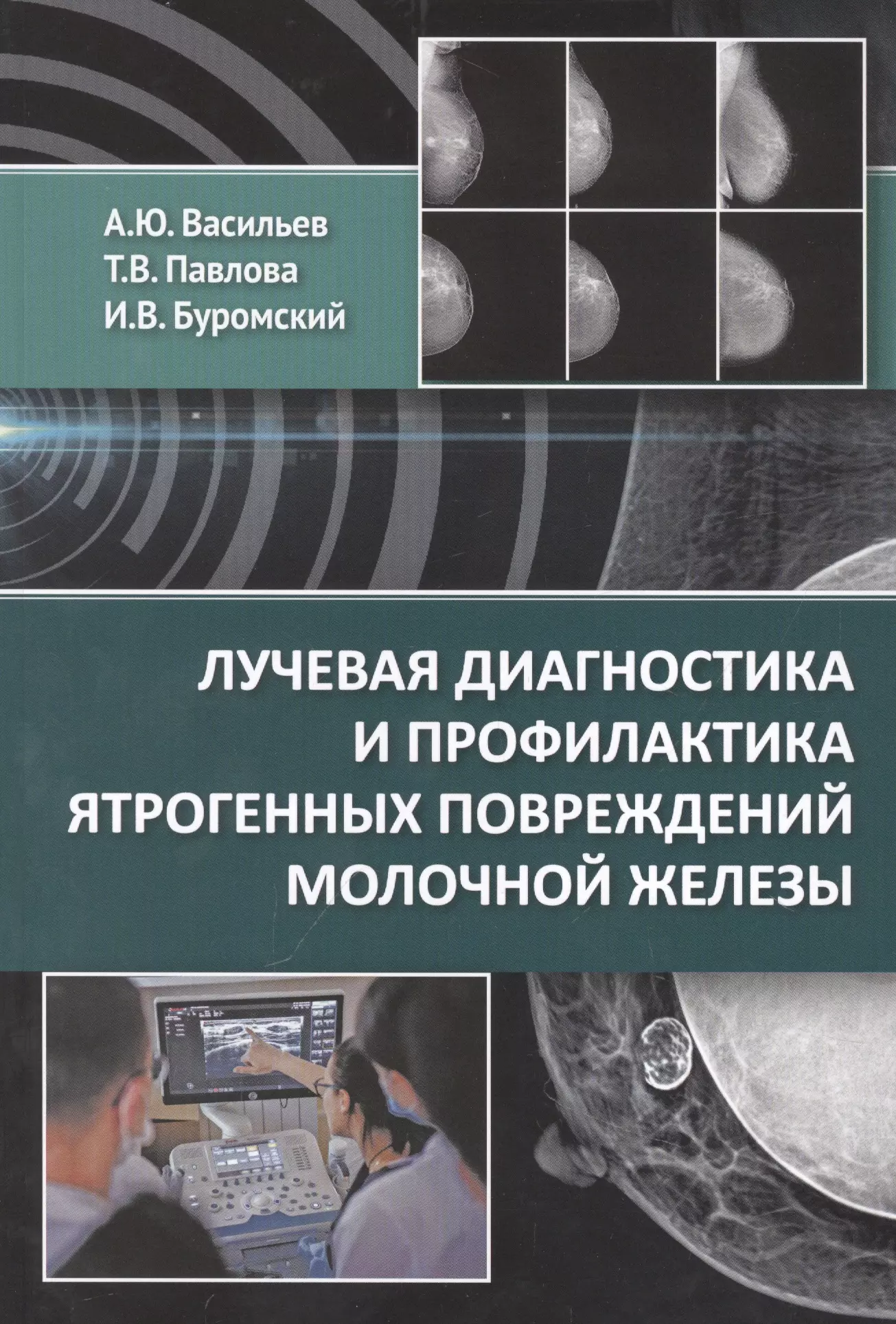 Буромский Иван Владимирович, Павлова Татьяна Владимировна, Васильев Александр Юрьевич - Лучевая диагностика и профилактика ятрогенных повреждений молочной железы