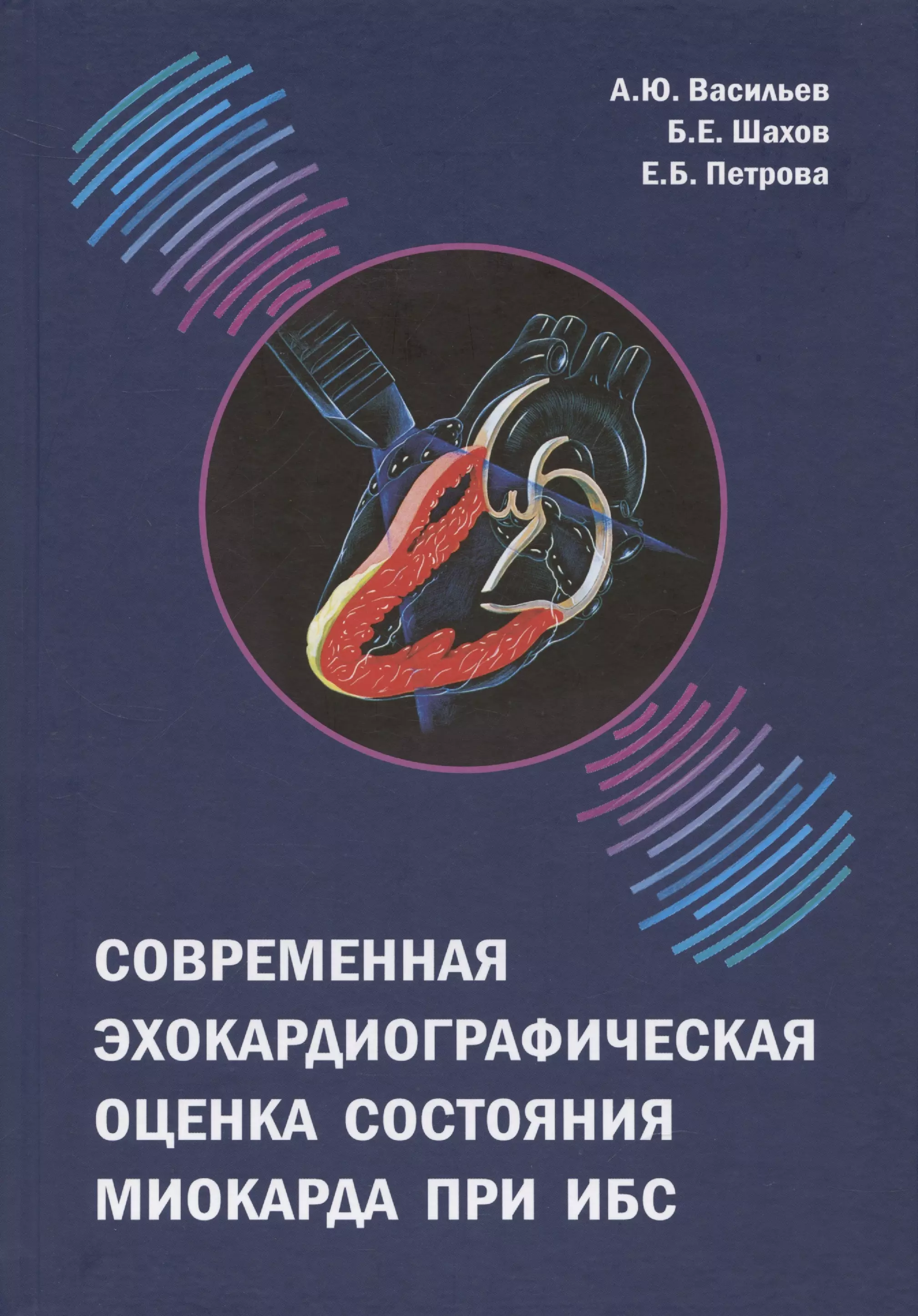 Васильев Александр Юрьевич, Петрова Екатерина Борисовна, Шахов Борис Евгеньевич - Современная эхокардиографическая оценка состояния миокарда при ИБС