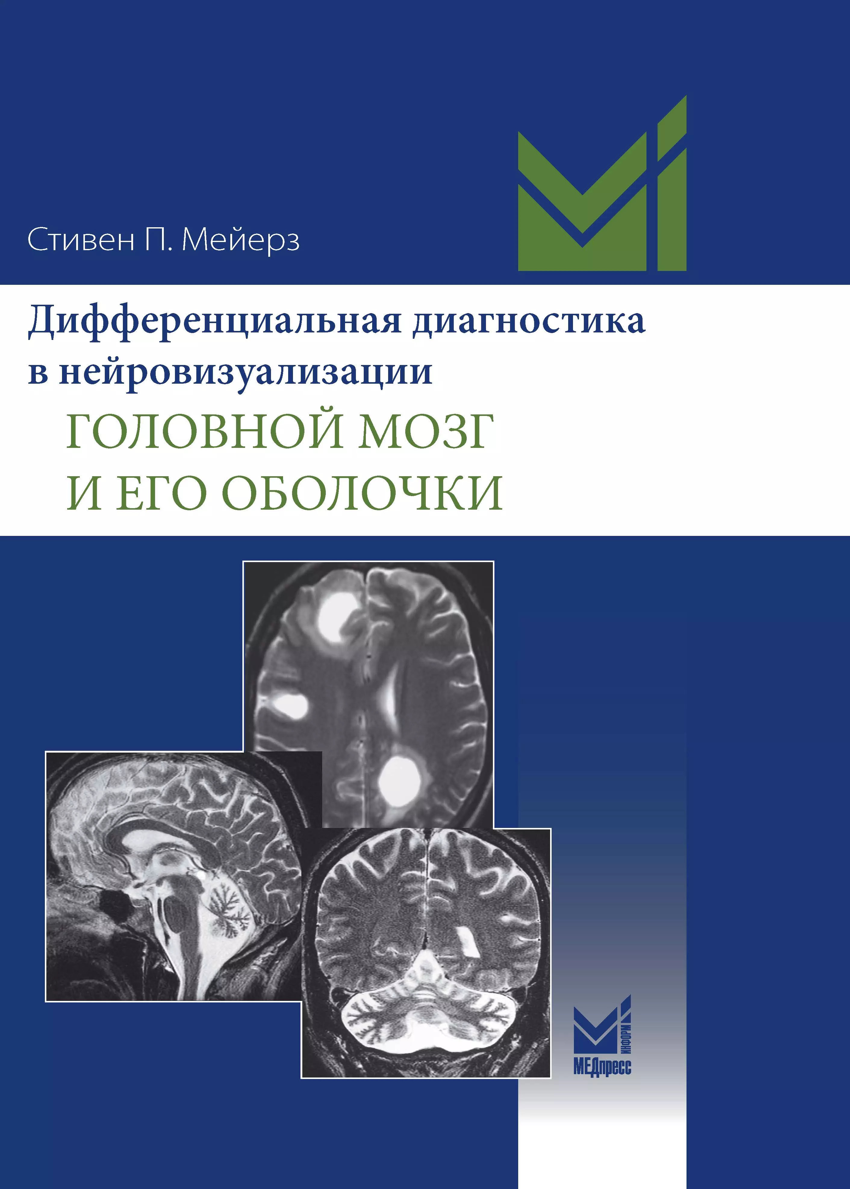 Мейерз Стивен П. - Дифференциальная диагностика в нейровизуализации. Головной мозг и его оболочки