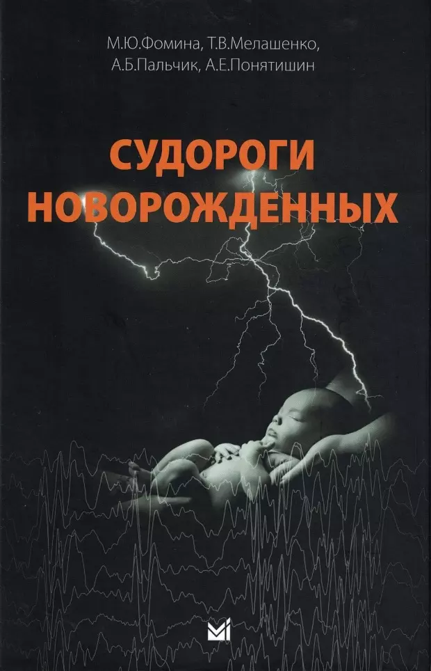 Пальчик Александр Бейнусович, Фомина Мария Юрьевна, Мелашенко Татьяна Владимировна - Судороги новорожденных