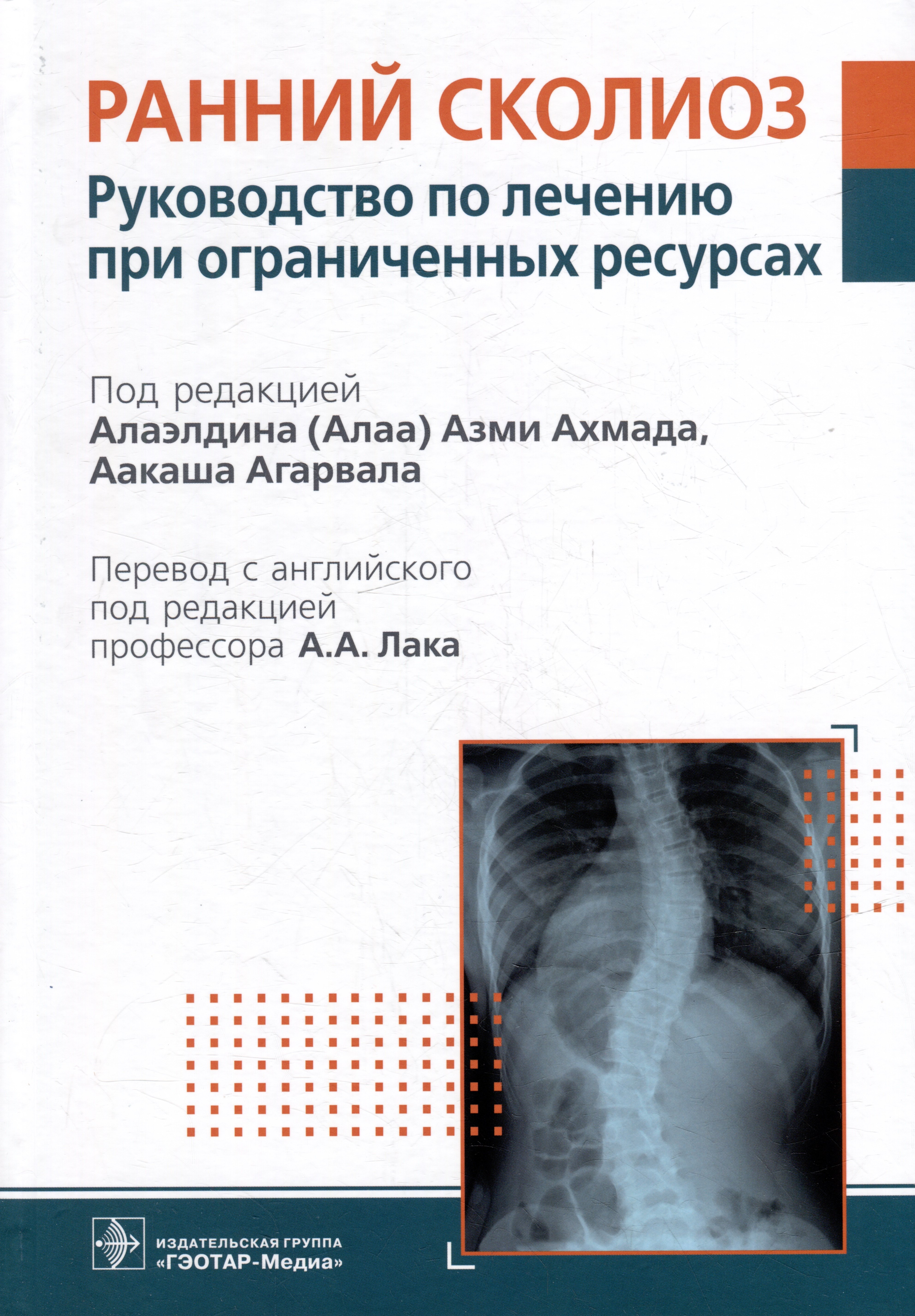 

Ранний сколиоз. Руководство по лечению при ограниченных ресурсах